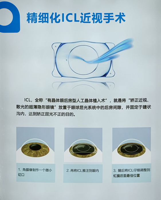 寒假摘鏡總動員，近視朋友的三種矯正近視方式